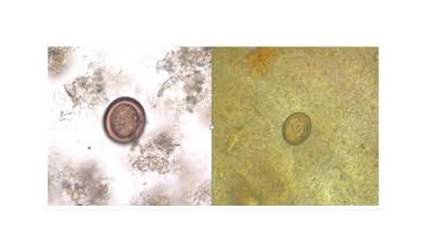 آزمایشگاه تشخیص طبی در اصفهان ، آزمایش زگیل تناسلی ، آزمایشات بارداری در اصفهان ، بهترین آزمایشگاه در اصفهان ، آزمایش hpv در اصفهان ، آزمایش کبد چرب ، بهترین آزمایشگاه اصفهان