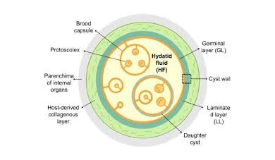 آزمایشگاه تشخیص طبی در اصفهان ، آزمایش زگیل تناسلی ، آزمایشات بارداری در اصفهان ، بهترین آزمایشگاه در اصفهان ، آزمایش hpv در اصفهان ، آزمایش کبد چرب ، بهترین آزمایشگاه اصفهان
