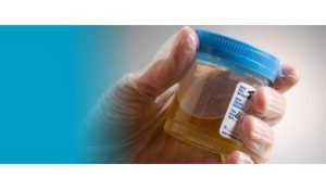 آزمایشگاه تشخیص طبی در اصفهان ، آزمایش زگیل تناسلی ، آزمایشات بارداری در اصفهان ، بهترین آزمایشگاه در اصفهان ، آزمایش hpv در اصفهان ، آزمایش کبد چرب ، بهترین آزمایشگاه اصفهان