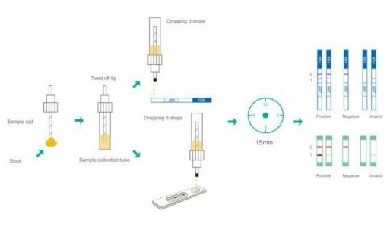 آزمایشگاه تشخیص طبی در اصفهان ، آزمایش زگیل تناسلی ، آزمایشات بارداری در اصفهان ، بهترین آزمایشگاه در اصفهان ، آزمایش hpv در اصفهان ، آزمایش کبد چرب ، بهترین آزمایشگاه اصفهان