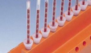 آزمایشگاه تشخیص طبی در اصفهان ، آزمایش زگیل تناسلی ، آزمایشات بارداری در اصفهان ، بهترین آزمایشگاه در اصفهان ، آزمایش hpv در اصفهان ، آزمایش کبد چرب ، بهترین آزمایشگاه اصفهان