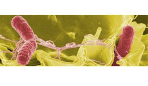 آزمایشگاه تشخیص طبی در اصفهان ، آزمایش زگیل تناسلی ، آزمایشات بارداری در اصفهان ، بهترین آزمایشگاه در اصفهان ، آزمایش hpv در اصفهان ، آزمایش کبد چرب ، بهترین آزمایشگاه اصفهان