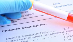 آزمایشگاه تشخیص طبی در اصفهان ، آزمایش زگیل تناسلی ، آزمایشات بارداری در اصفهان ، بهترین آزمایشگاه در اصفهان ، آزمایش hpv در اصفهان ، آزمایش کبد چرب ، بهترین آزمایشگاه اصفهان