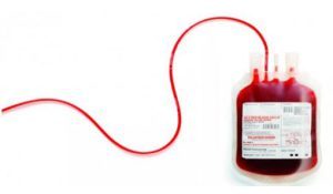 آزمایشگاه تشخیص طبی در اصفهان ، آزمایش زگیل تناسلی ، آزمایشات بارداری در اصفهان ، بهترین آزمایشگاه در اصفهان ، آزمایش hpv در اصفهان ، آزمایش کبد چرب ، بهترین آزمایشگاه اصفهان