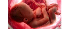 آزمایشگاه تشخیص طبی در اصفهان ، آزمایش زگیل تناسلی ، آزمایشات بارداری در اصفهان ، بهترین آزمایشگاه در اصفهان ، آزمایش hpv در اصفهان ، آزمایش کبد چرب ، بهترین آزمایشگاه اصفهان
