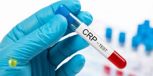 آزمایش CRP