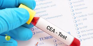 آزمایش CEA