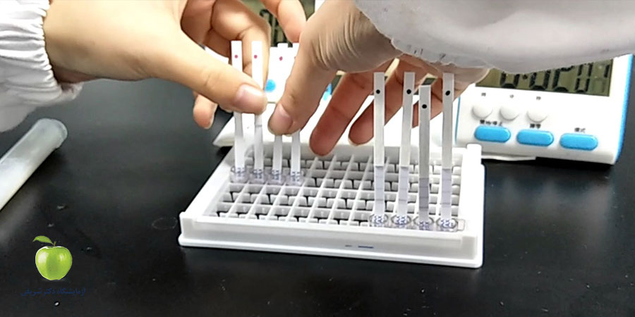 تفسیر آزمایش SGPT