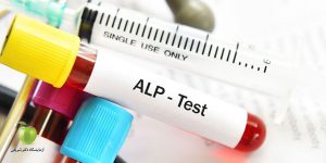 آزمایش ALP