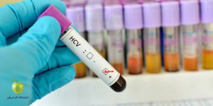 آزمایش HCV