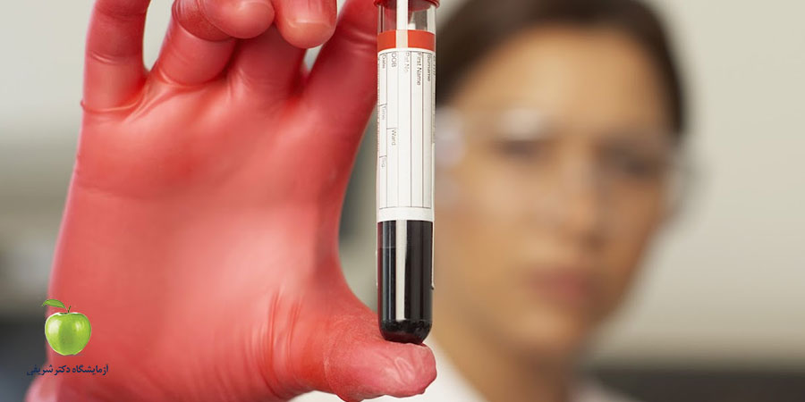 تفسیر آزمایش SGOT