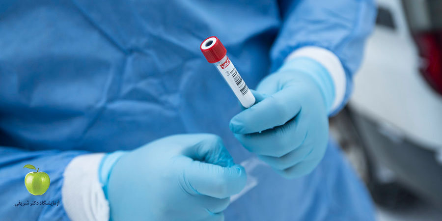 آزمایش قند دو ساعته