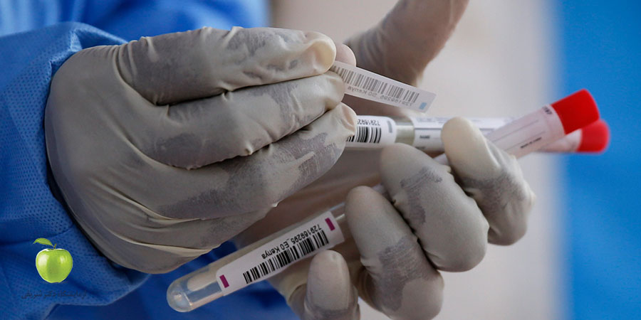 آمادگی جهت انجام آزمایش HBS-ag