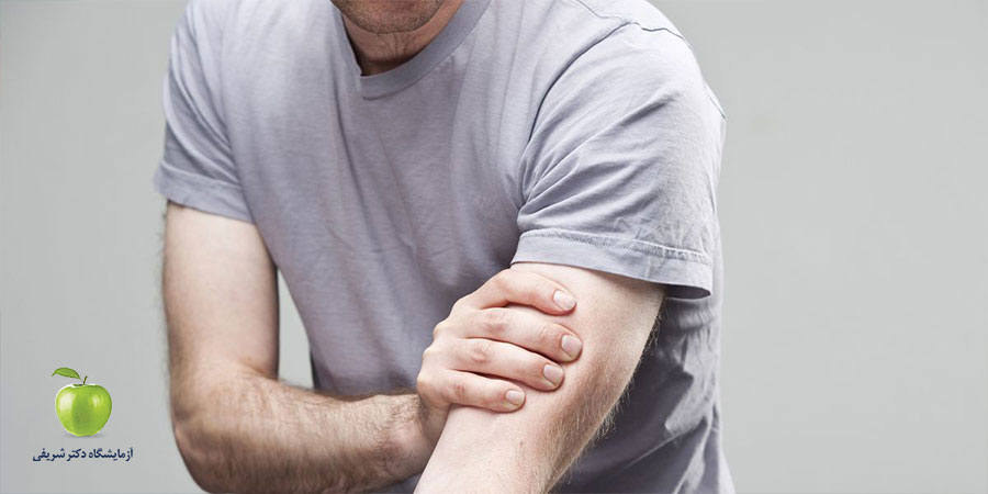 آیا همه افرادی که درد و ضعف عضلانی دارند باید تست CPK انجام دهند؟