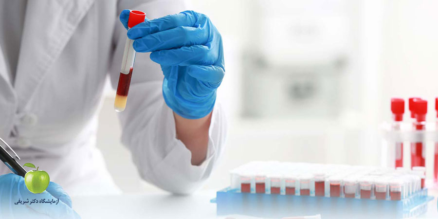 چه زمانی به آزمایش CBC نیاز داریم؟