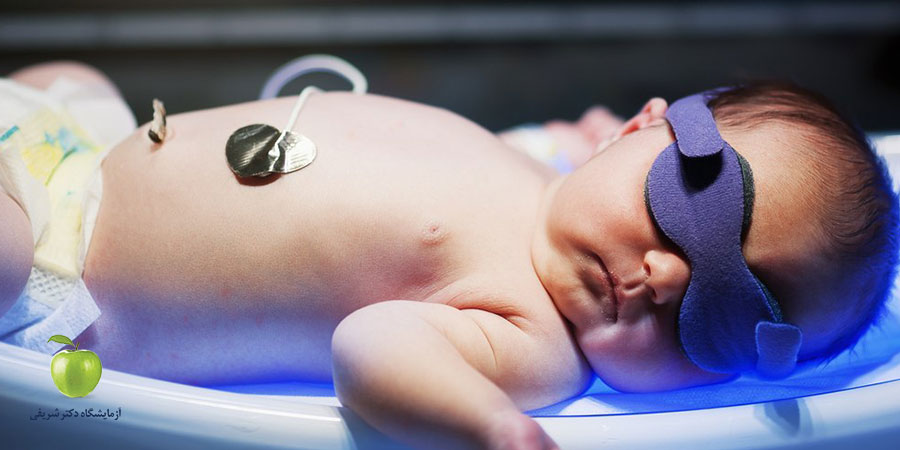 آزمایش زردی نوزاد با دستگاه