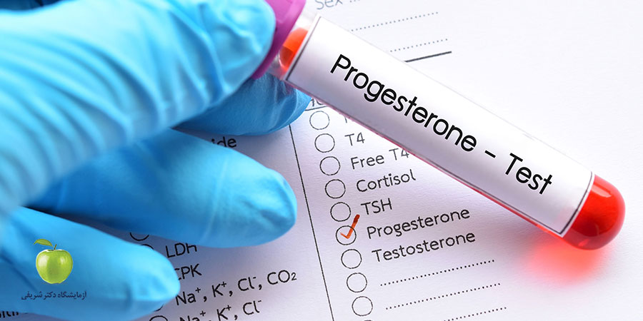 تفسیر آزمایش پروژسترون