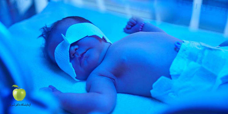 مقادیر طبیعی آزمایش بیلیروبین